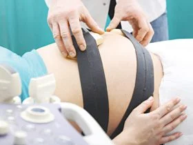 Mốc khám thai lần 8  chạy máy monitor